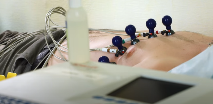 ekg